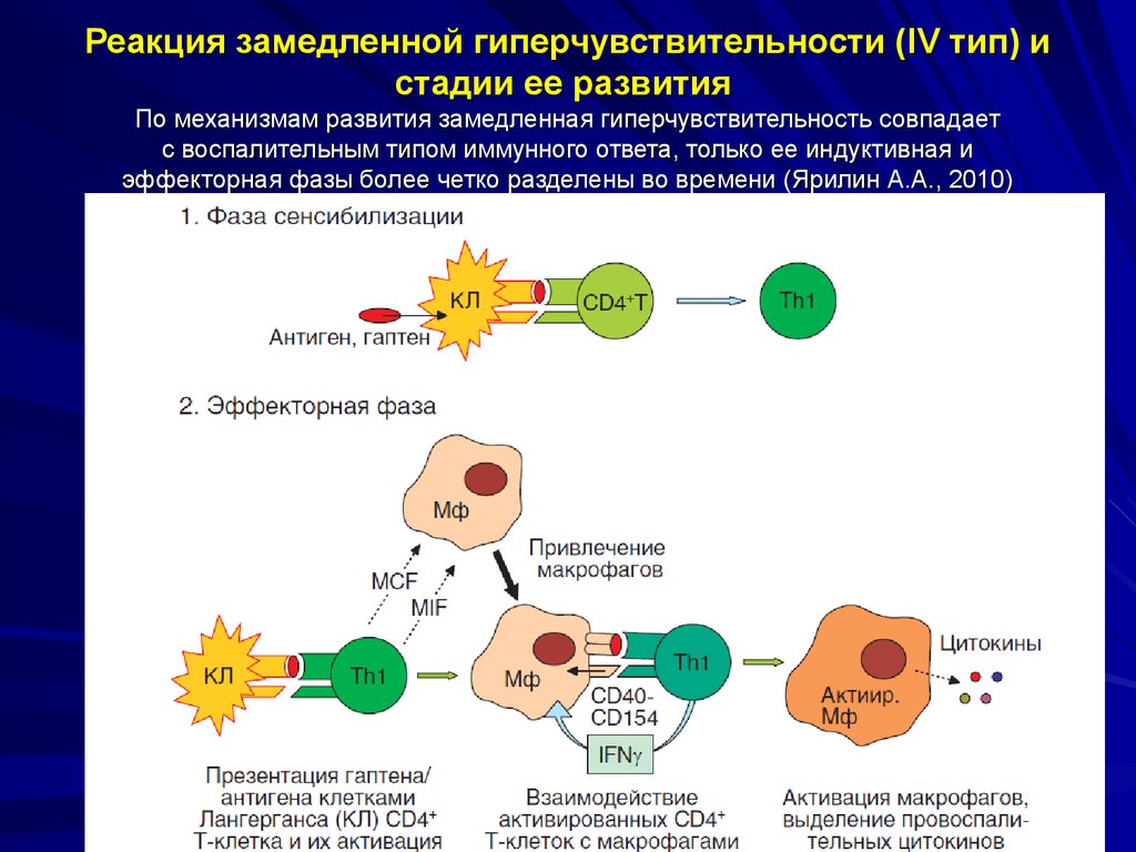 Антигены макрофагов. Реакция гиперчувствительности замедленного типа схема. Механизмы развития реакции гиперчувствительности схема. Реакция иммунной системы гиперчувствительности типа 4. Механизм возникновения реакции ГЗТ.