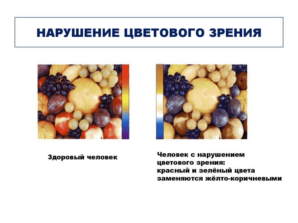 Нарушение цветового зрения. Нарушение цветового восприятия. Нарушение восприятия цветов. Формы нарушения цветового зрения.