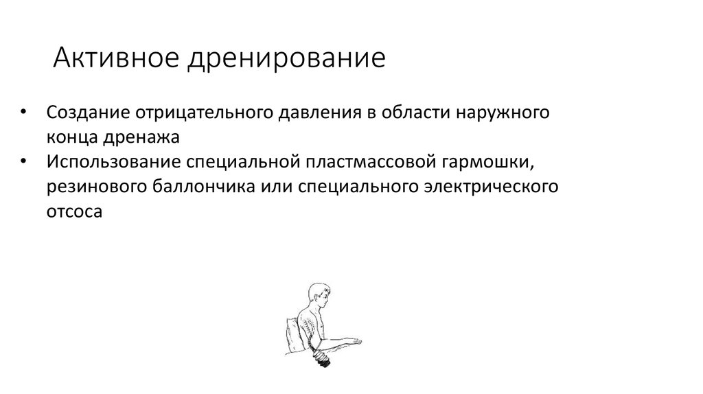 Активные создание. Активное и пассивное дренирование раны. Активное дренирование. Активный и пассивный дренаж. Активное дренирование РАН.