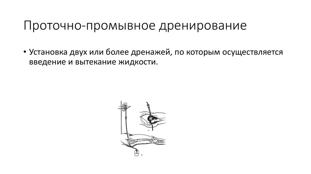 Картинки дренирование раны