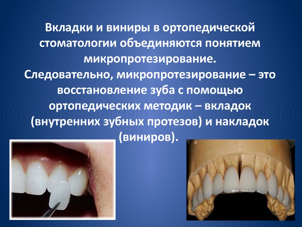 Искусственные зубы и их виды презентация