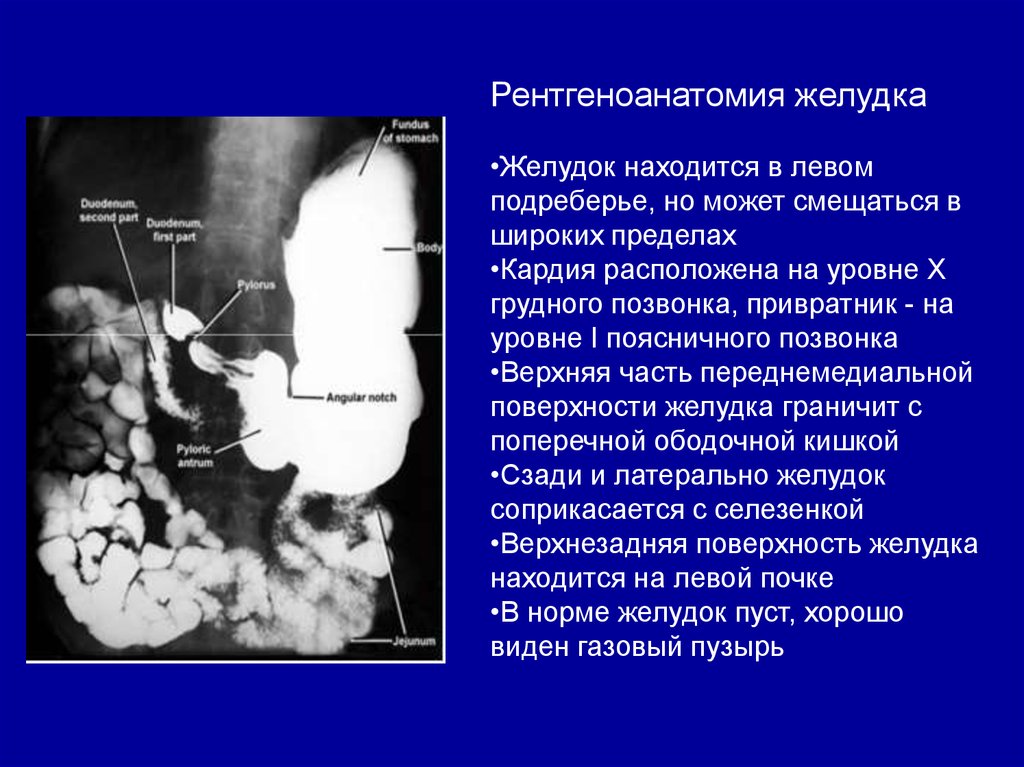 Рентгеноскопия двенадцатиперстной кишки. Нормальная анатомия желудка рентген. Рентгенологическая номенклатура желудка. Отделы желудка анатомия рентген. Рентген исследование желудка показания.