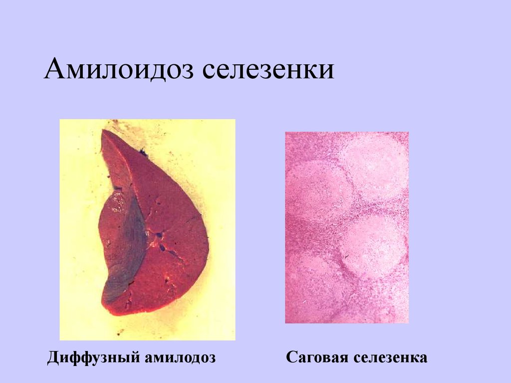 Саговая селезенка микропрепарат рисунок