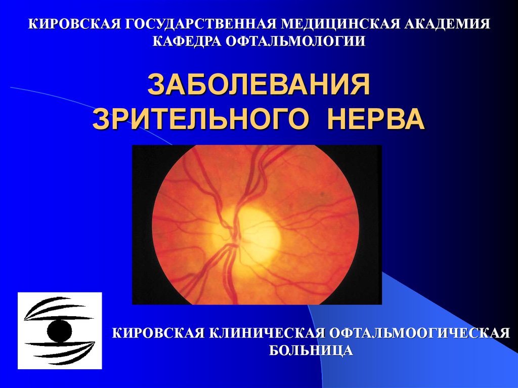 Место выхода зрительного нерва. Заболевания зрительного нерва. Нарушения зрительного нерва. Патология зрительного нерва. Заболевания диска зрительного нерва.