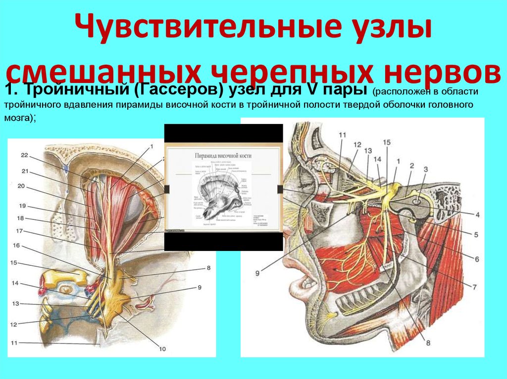 3 4 черепные нервы. Функциональная анатомия черепных нервов. Чувствительные узлы черепных нервов. Вдавление тройничного нерва. 10 Пара черепных нервов ядра.