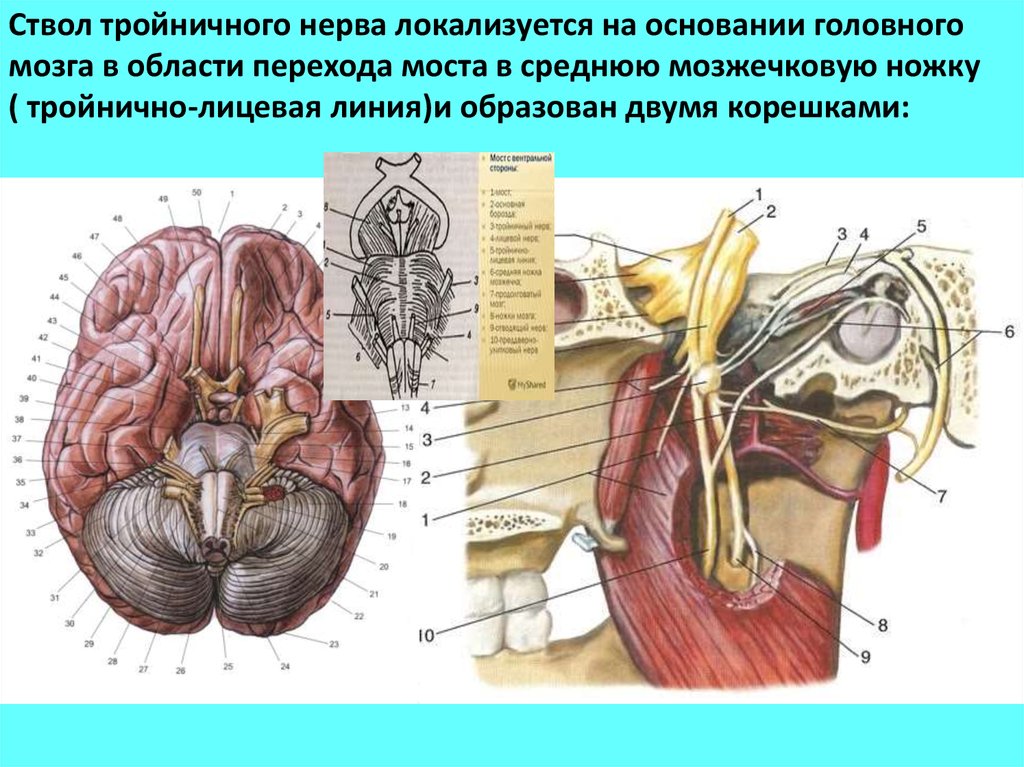 Черепные нервы моста. Тройничный нерв мост анатомия. Ствол тройничного нерва. Корешок тройничного нерва анатомия. Тройничный нерв на основании головного мозга.