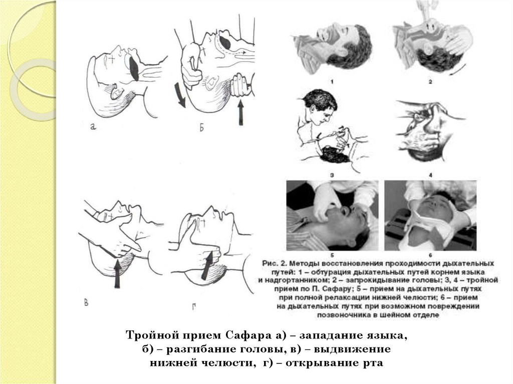 Карта вызова клиническая смерть реанимация