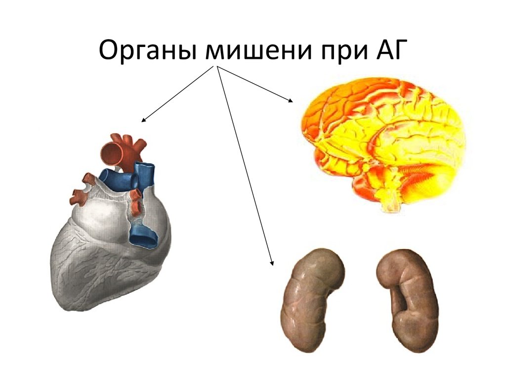 Патанатомия гипертоническая болезнь презентация