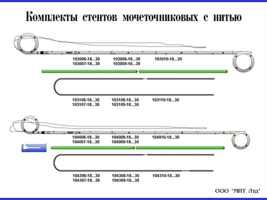 Стенд на мочеточнике фото