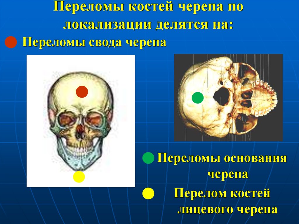 Картинки перелом черепа