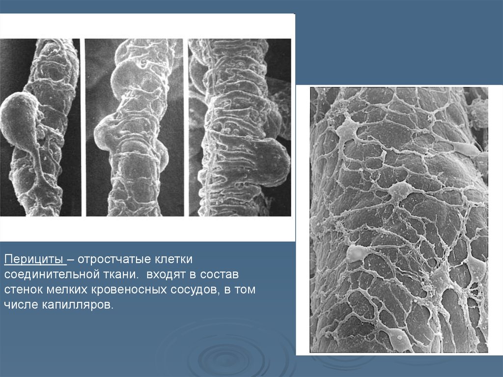 Ткани стенок сосудов. Перициты гистология. Клетки перициты. Перициты соединительной ткани. Перициты строение.