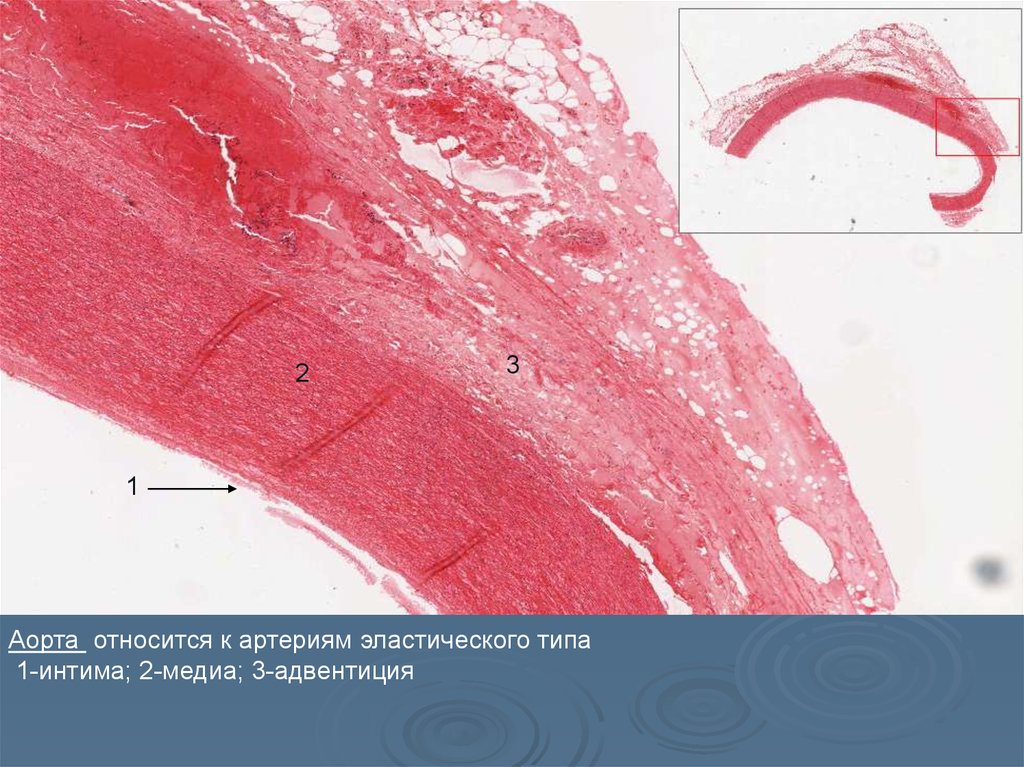 Артерия эластического типа рисунок