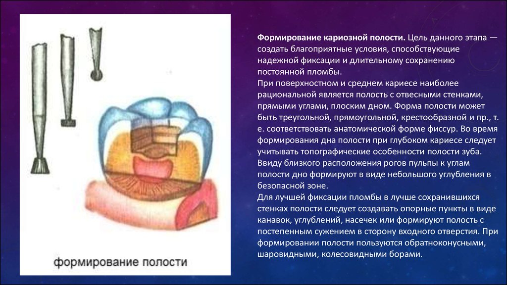 Полость использовать. Формирование кариозной полости. Этапы формирования кариозной полости. Боры для формирования кариозной полости. Этапы раскрытия кариозной полости.