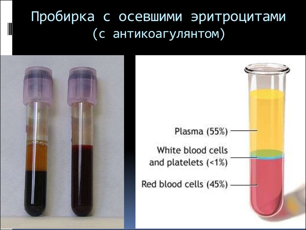 Почему кровь желтая. Гемолиз в пробирке. Пробирка с кровью после центрифугирования. Гемолизная сыворотка крови. Плазма крови в пробирке.