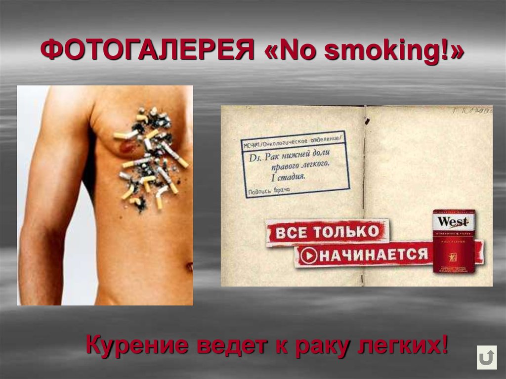 ФОТОГАЛЕРЕЯ «No smoking!»