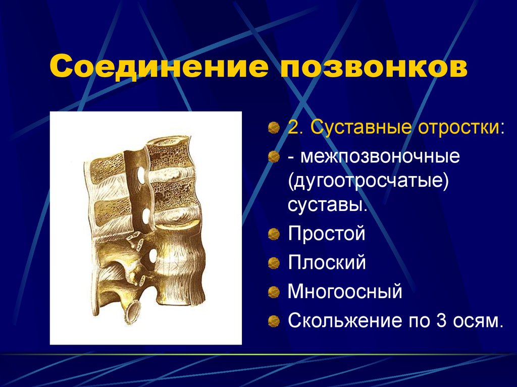 Суставные отростки. Дугоотросчатые суставы позвонков. Межпозвоночный диск Тип соединения костей. Межпозвоночные дугоотростчатые суставы связки. Соединение суставных отростков позвонков.