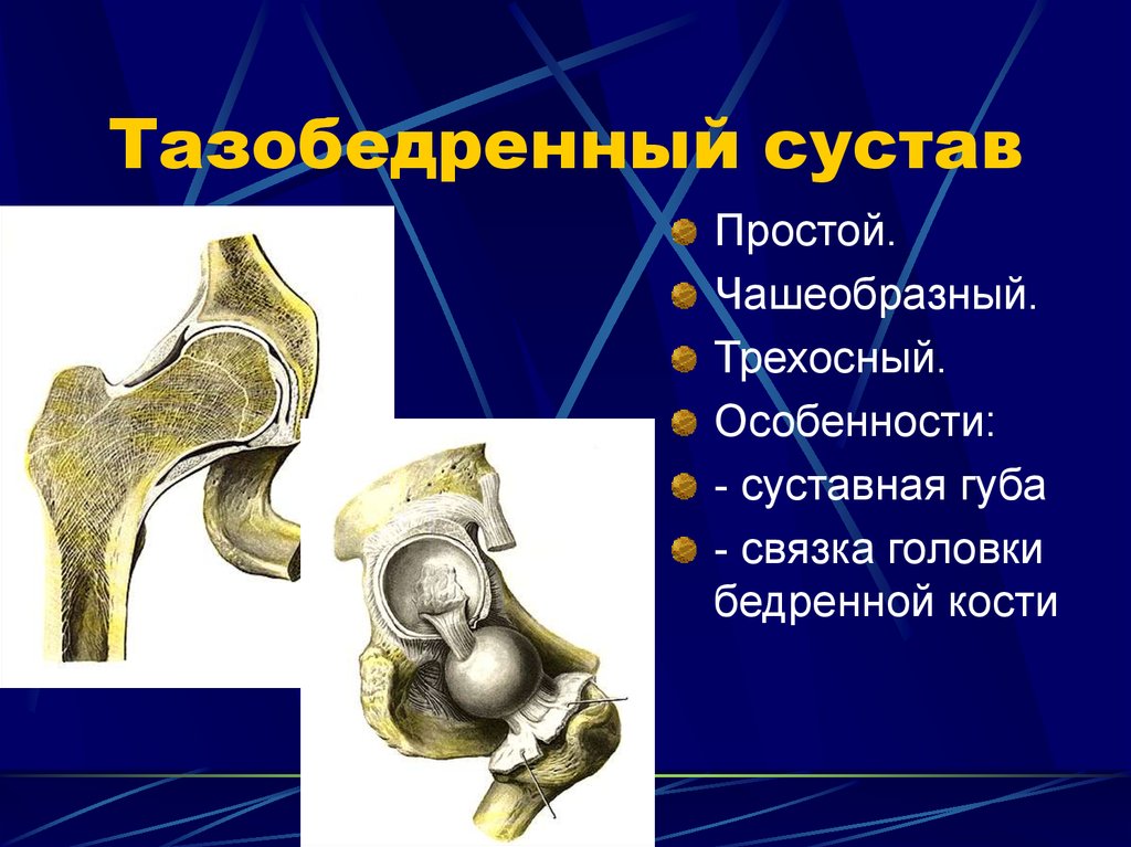 Рисунок тазобедренного сустава человека