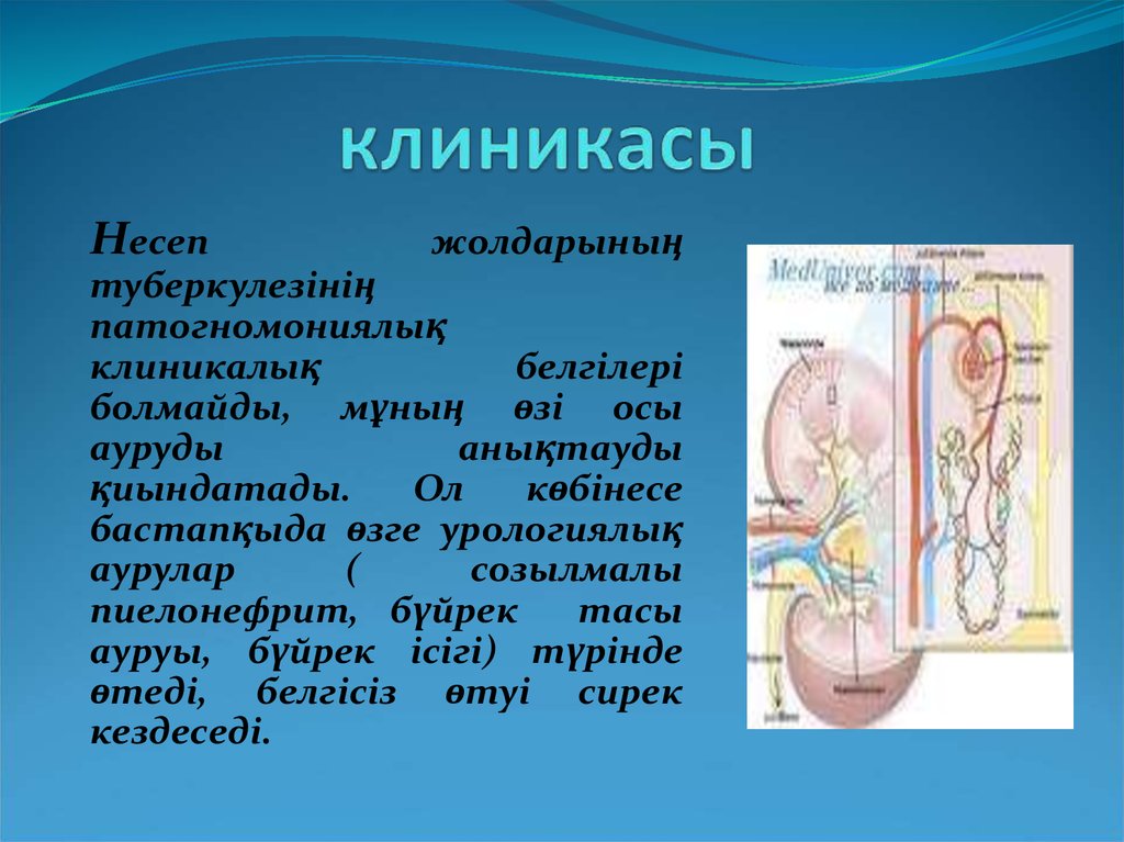 Презентация несеп тас ауруы