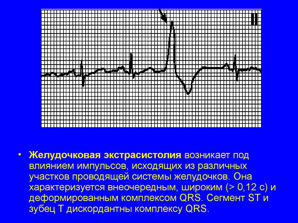 Электрические явления в сердце