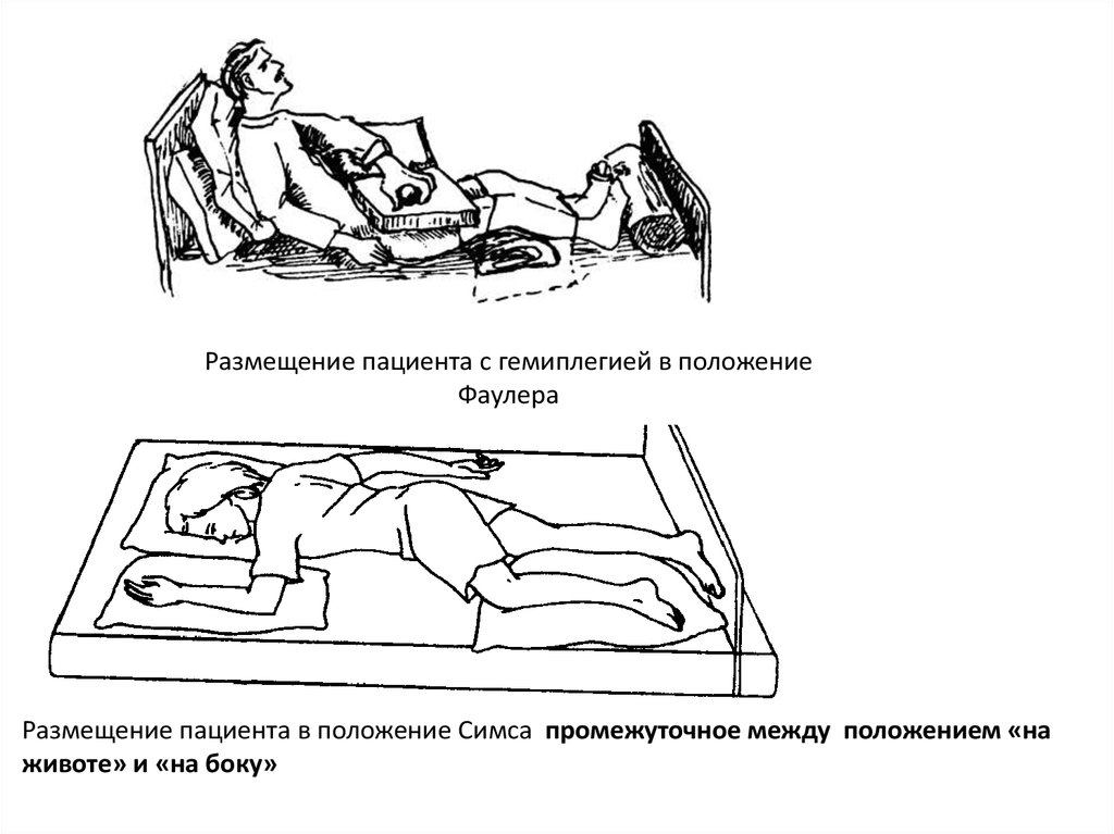 Положение симса это. Положение пациента Фаулера и симса. Положение Фаулера у пациента с гемиплегией. Фаулер симс положение. Размещение пациента в положение симса и Фаулера.