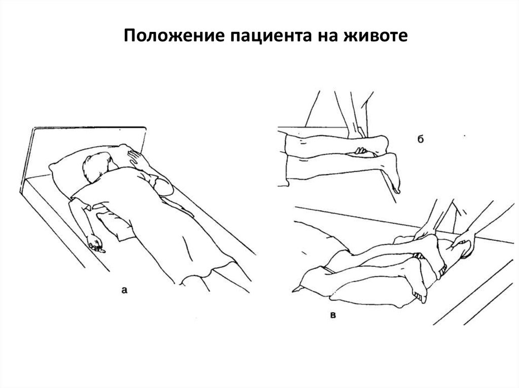 Положение лежа. Укладывание пациента в положение на животе. Перемещение пациента на живот. Размещение пациента в положение лежа на животе. Положение пациента в постели на животе.