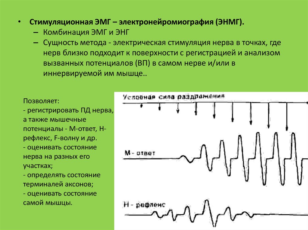 Амплитуда м ответа. М-ответ при электромиографии. Метод электромиографии физиология. Методика проведения ЭМГ. Электромиография расшифровка электромиограммы.