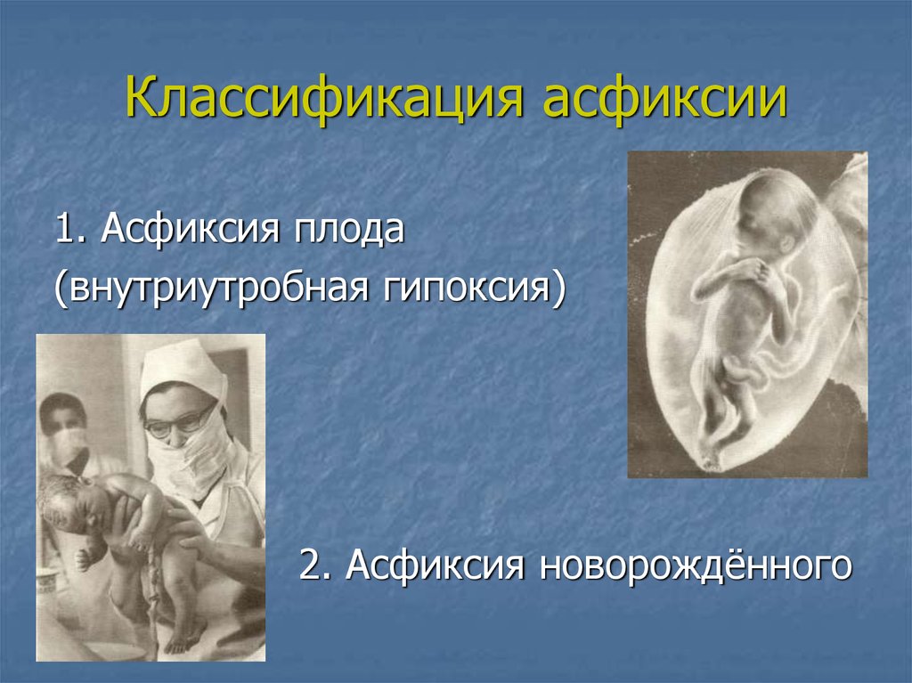 Антенатальная гибель плода. Внутриутробная асфиксия плода. Асфиксия плода классификация. Антенатальная асфиксия плода. Асфиксия новорожденного классификация.