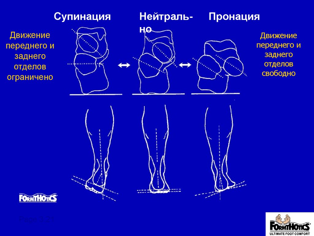 Нейтральное положение. Супинации заднего и пронации переднего отдела. Пронация переднего отдела стопы. Пронация и супинация стопы. Движения стопы пронация супинация.