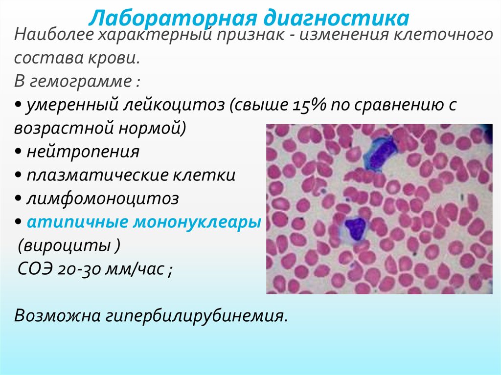 1 плазматическая клетка. Инфекционный мононуклеоз атипичные мононуклеары. Плазматические клетки в крови норма. Плазматические клетки в общем анализе крови. Плазматические клетки в мазке крови.