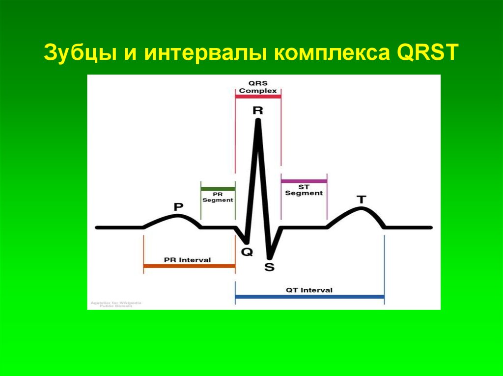 Qrs на экг что это. Длительность комплекса QRS В норме. Комплекс зубцов QRS на ЭКГ. Желудочковый комплекс QRST. Комплекс QRS на ЭКГ отражает.