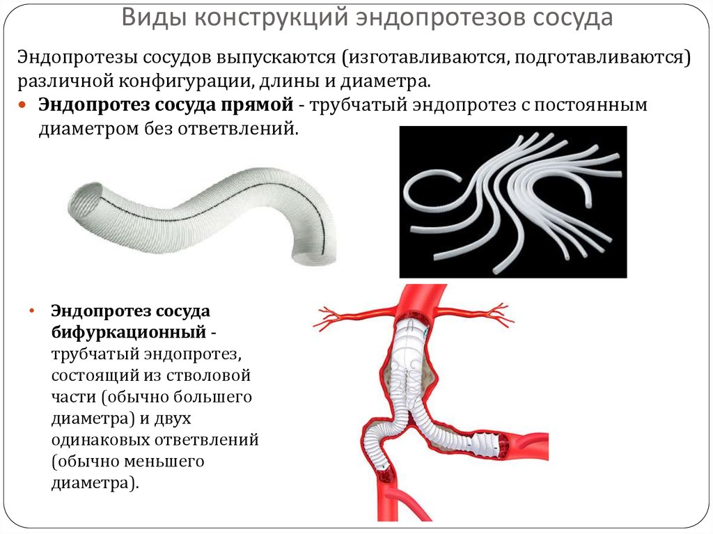 Виды сосудистых. Эндопротезы кровеносных сосудов. Бифуркационный сосудистый протез. Материалы для изготовления сосудистых эндопротезов.