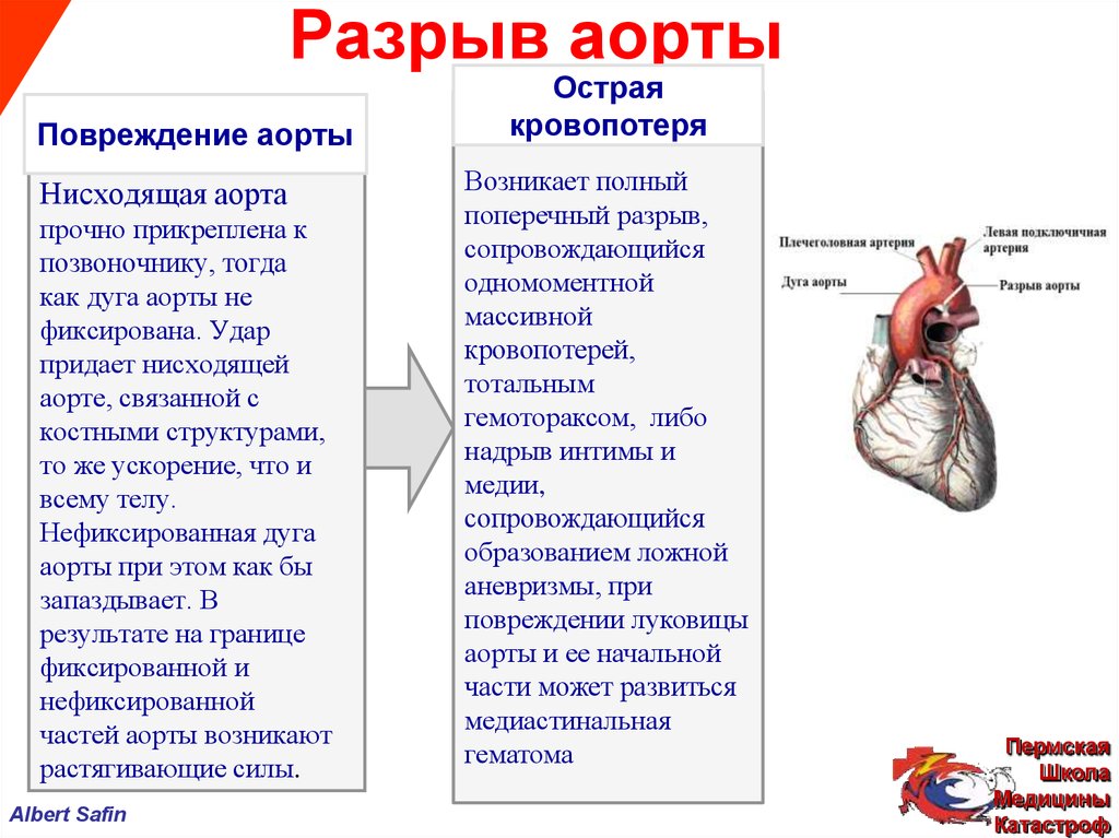 Разрыв это. Разрыв сердечной аорты.