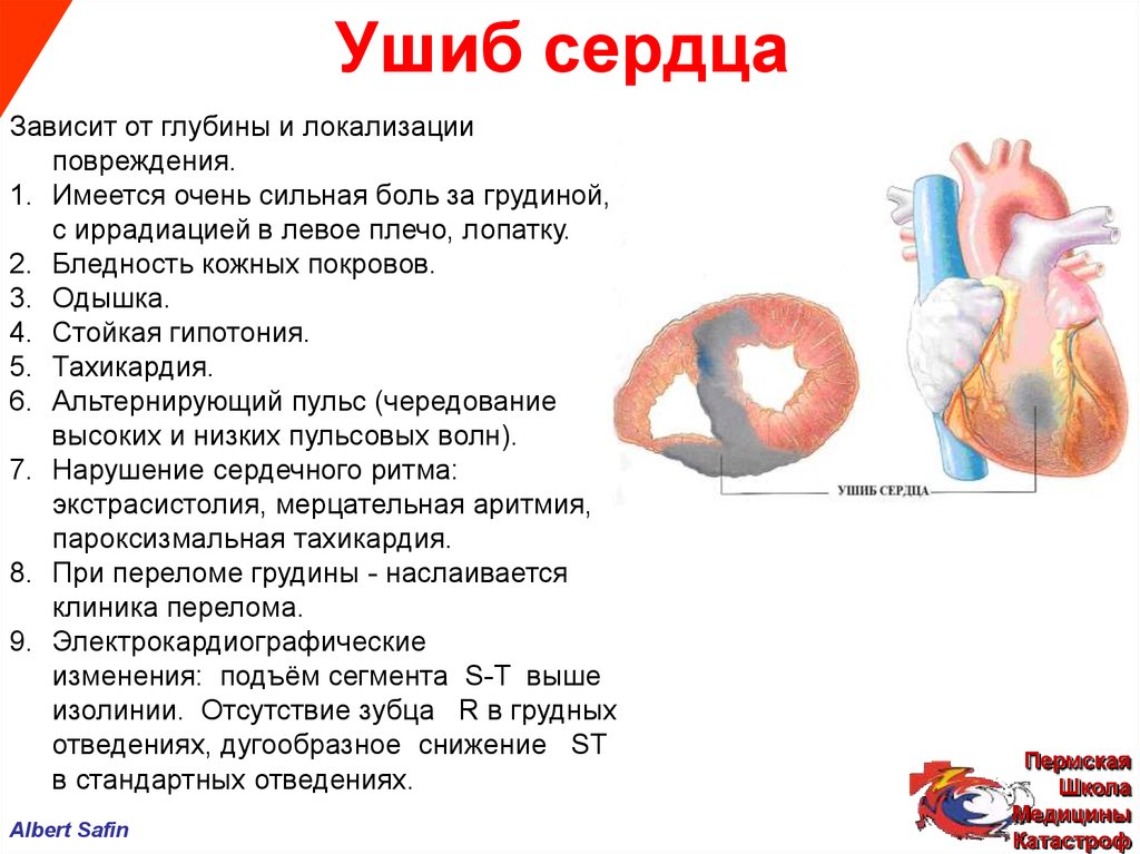 Закрытая травма сердца презентация