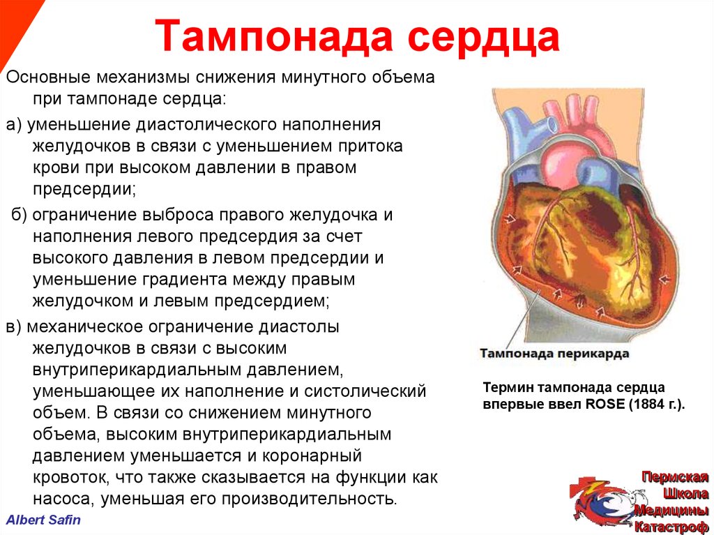 Давление крови в правом предсердии. Механизм развития тампонады сердца. Тампонада сердца причины. Тампонада перикарда причины. Гемотампонада сердца симптомы.