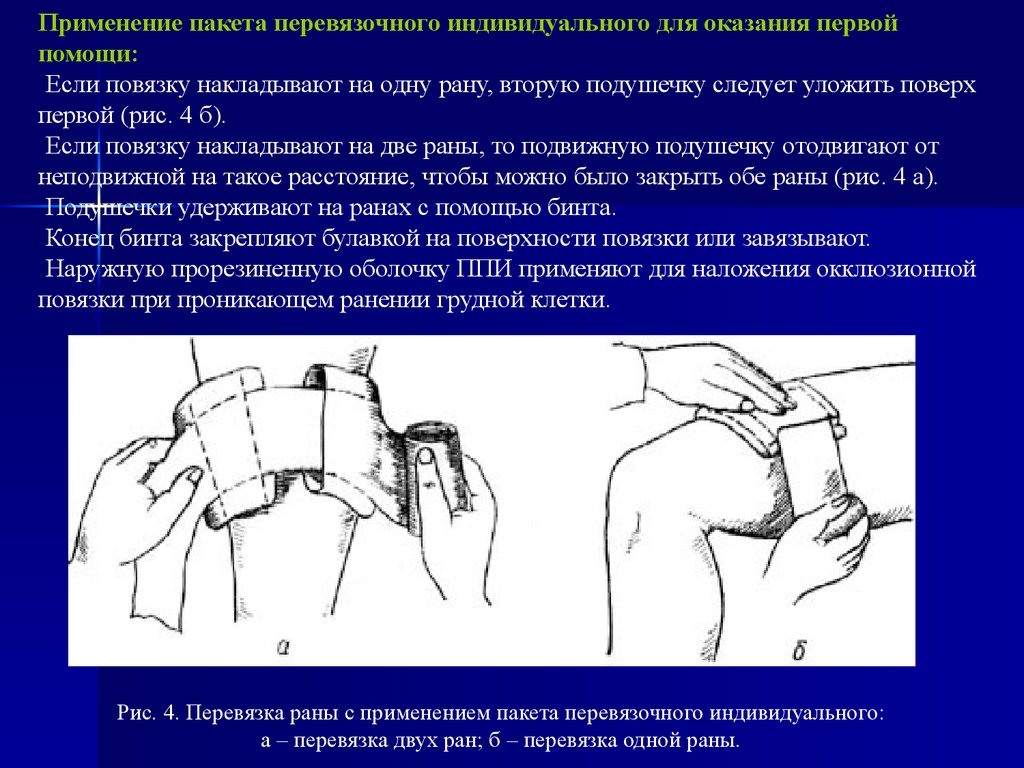 Как долго делать перевязки. Перевязка раны с применением пакета перевязочного индивидуального. Перевязочный пакет применение. Окклюзионная повязка накладывается. Применение индивидуального перевязочного пакета.