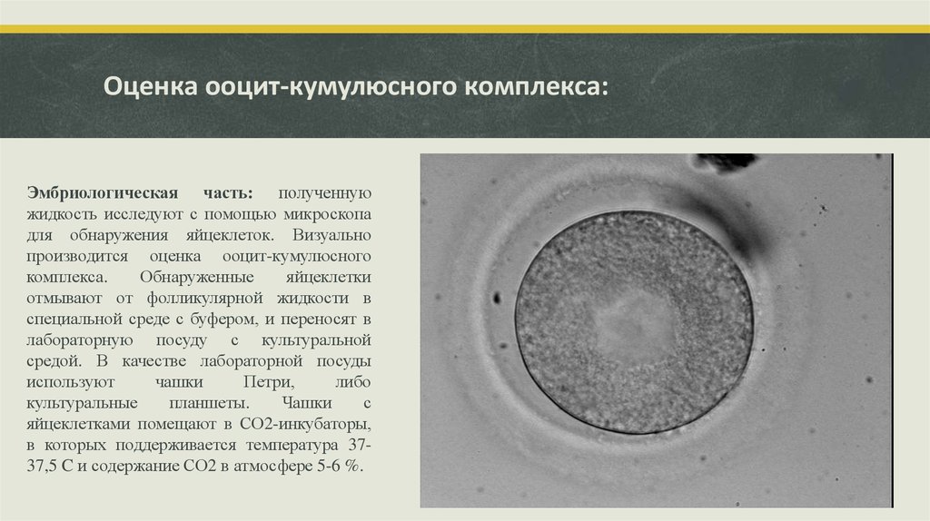 Ооциты качество. Ооцит кумулюсный комплекс. Ооцит 2. Оценка ооцит-кумулюсного комплекса. Оценка качества ооцитов.