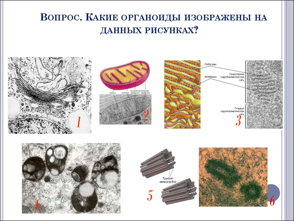 На рисунке изображен органоид. Органоид изображенный на рисунке. Какой оргонойд изображён на рисунке. Какой органоид изображен на рисунке. Органоиды клетки рисунки.