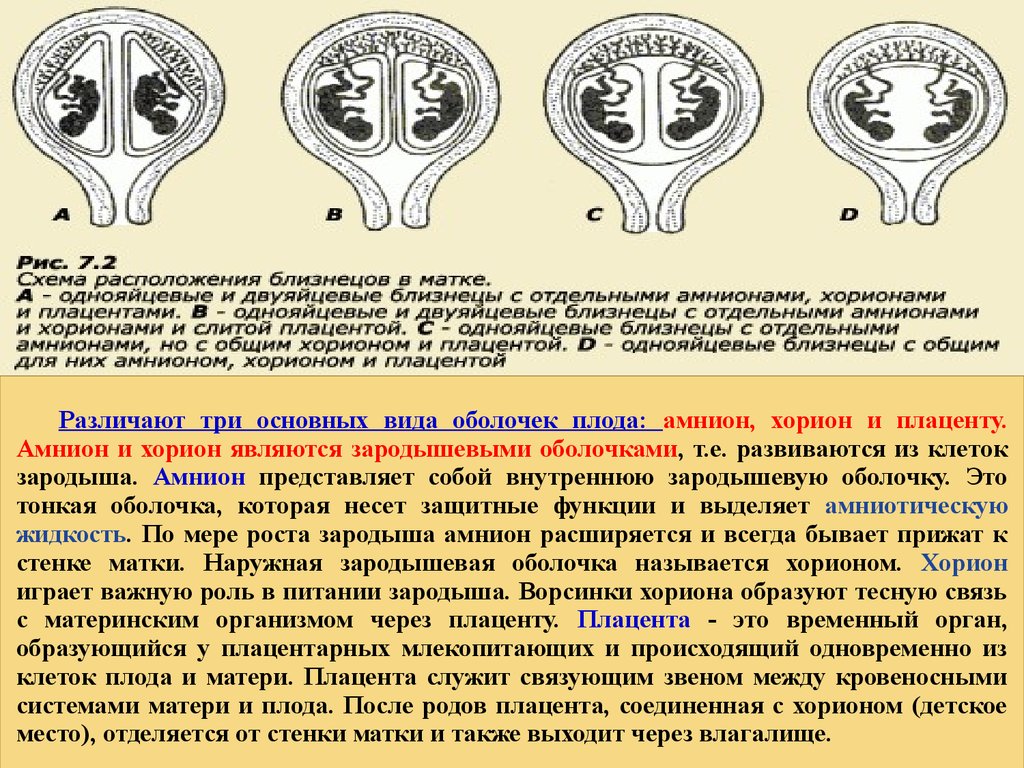 Виды близнецов схема