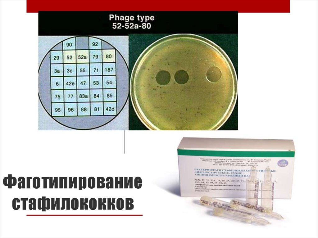 Чувствительность к бактериофагам. Фаготипирование стафилококка ауреус. Фаготипирование штаммов золотистого стафилококка. Метод фаготипирование стафилококка,. Метод фаготипирования микробиология.