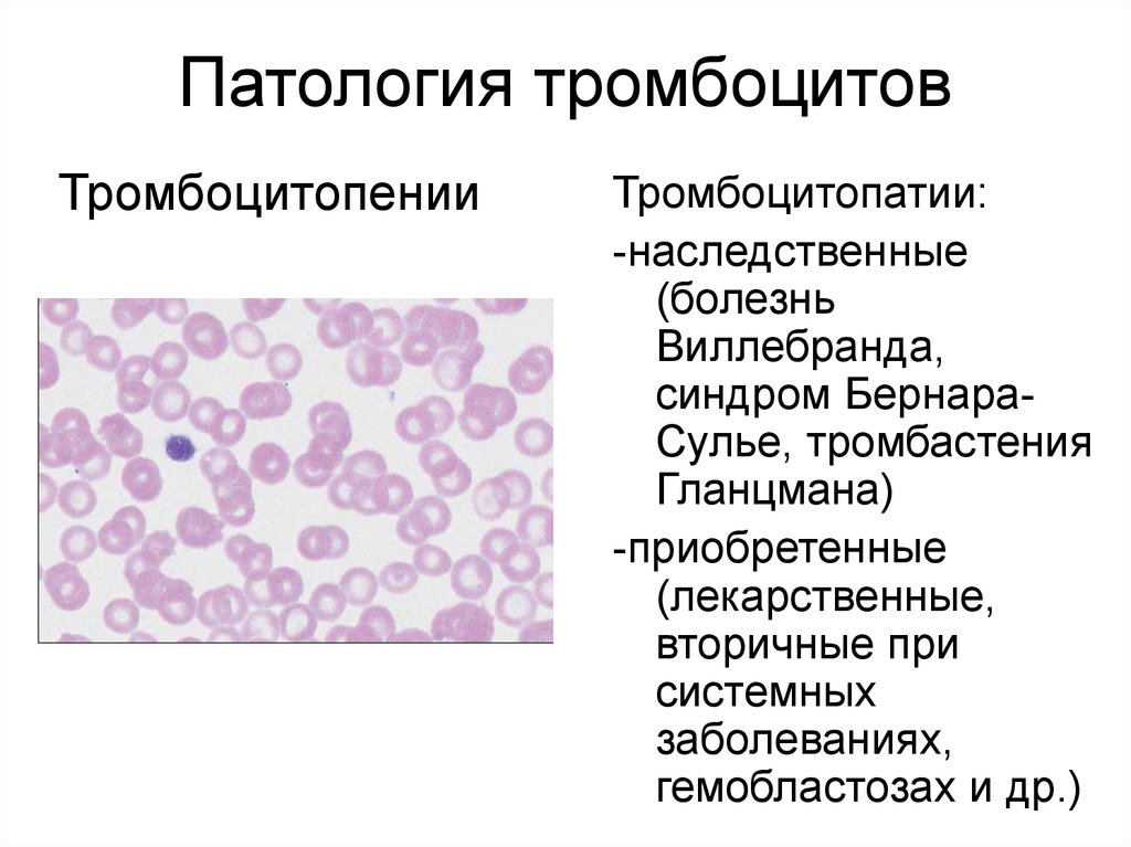 Лейкоцитоз тромбоцитопения. Синдром серых тромбоцитов. Тромбоцитопатия микроскопия. Патологические формы тромбоцитов.