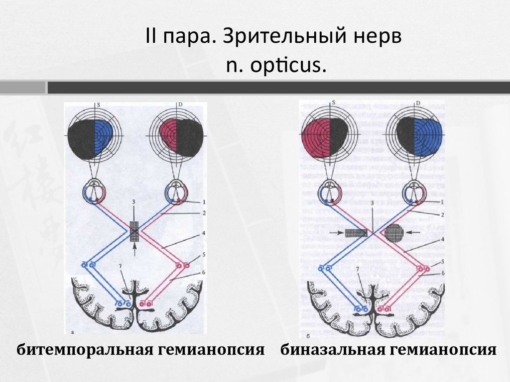 Зрительный нерв. Зрительный нерв (II пара, 2 пара, вторая пара черепных нервов), n. Opticus. Зрительный нерв 2 пара анатомия. Зрительный нерв 2 пара черепных нервов. Зрительный нерв (II пара) схема.