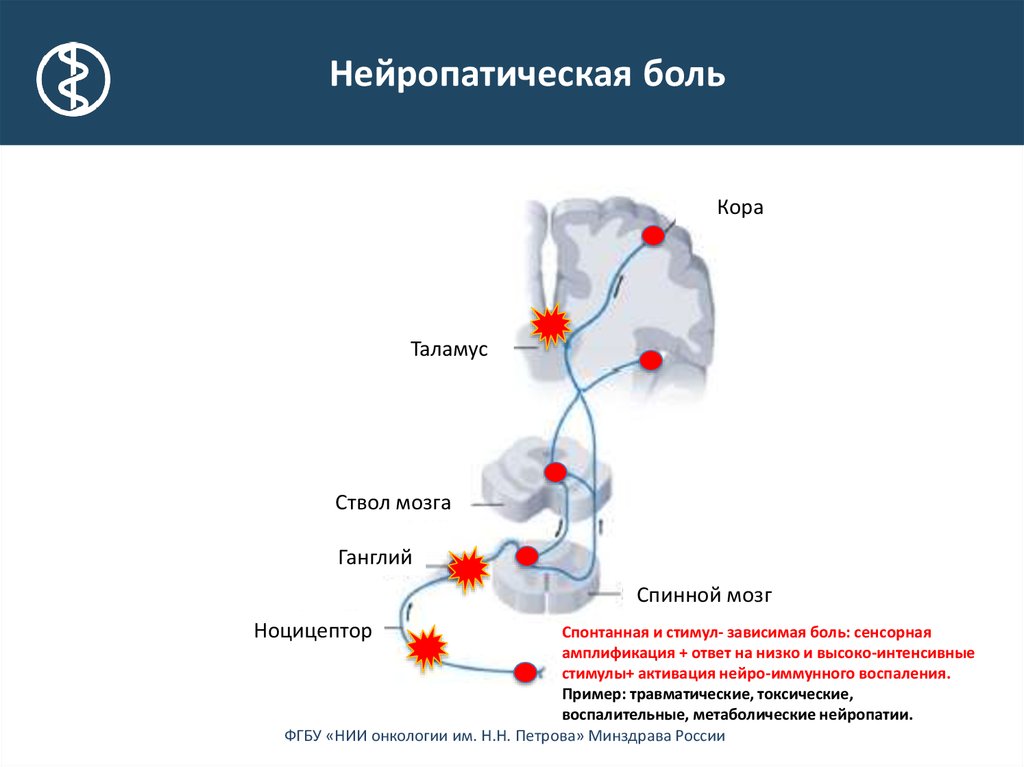 Боль высокой интенсивности