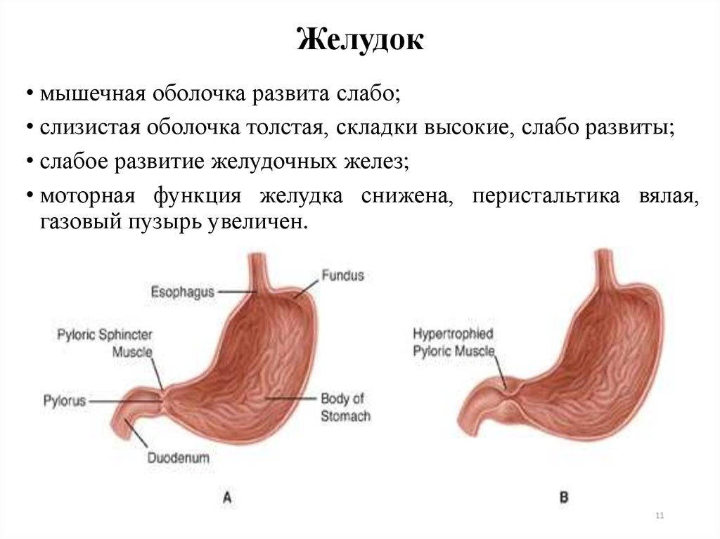 Волосы в желудке фото