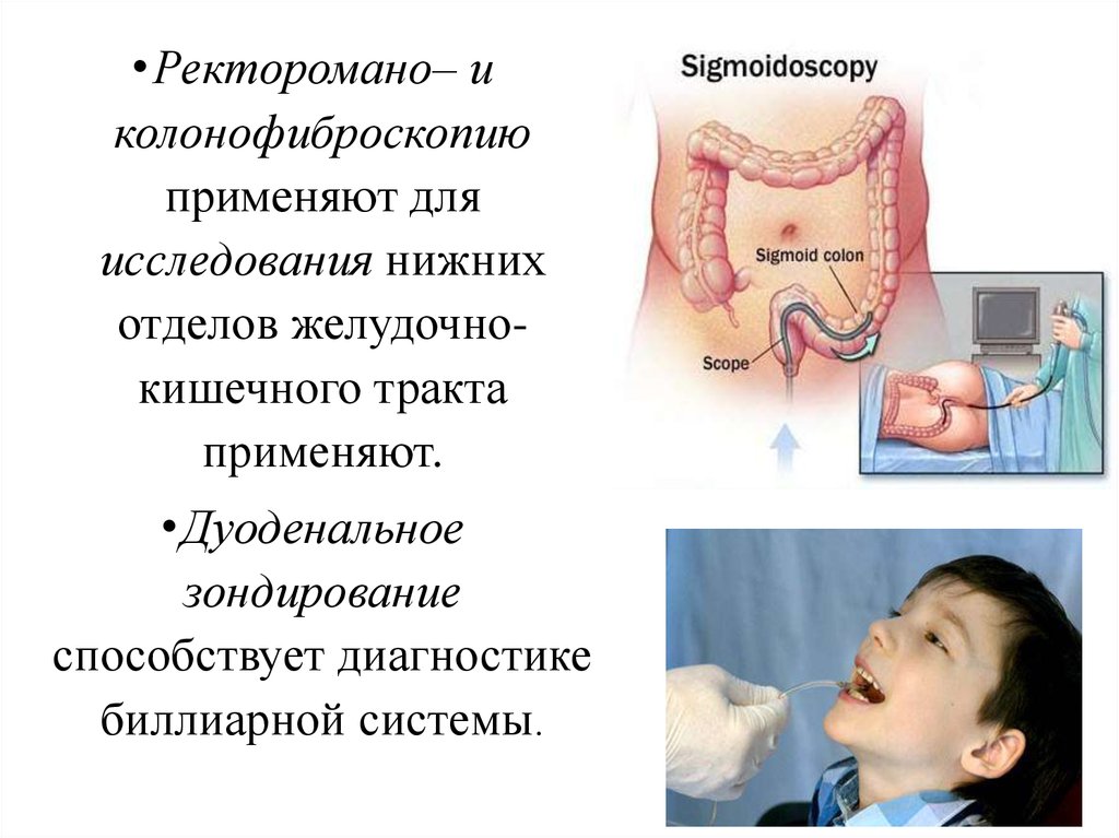 Зондирование. Зондирование пищеварительной системы. Зондирование кишечного тракта. Дуоденальное зондирование у детей. Дуоденальное зондирование фото для презентации.