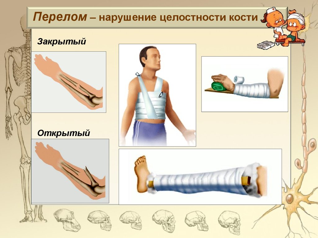 Урок-игра. Строение скелета - презентация онлайн