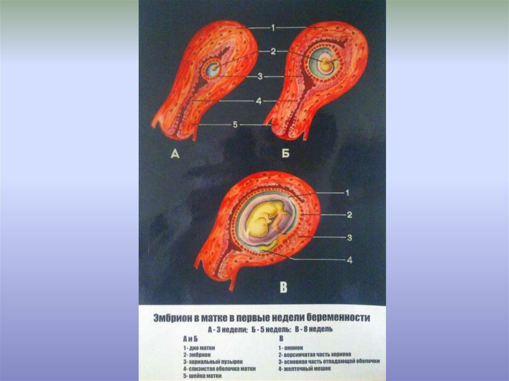 Плод в матке. Место прикрепления зародыша к матке. Место прикрепления эмбриона в матке. Эмбрион на 3 неделе в матке.