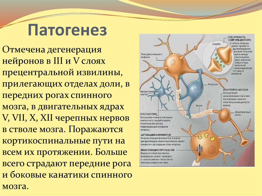 Дегенерация клеток. Боковой амиотрофический склероз патогенез. Боковой амиотрофический склероз неврология патогенез. Патогенез бокового амиотрофического. Боковой амиотрофический склероз патогенез клиника.