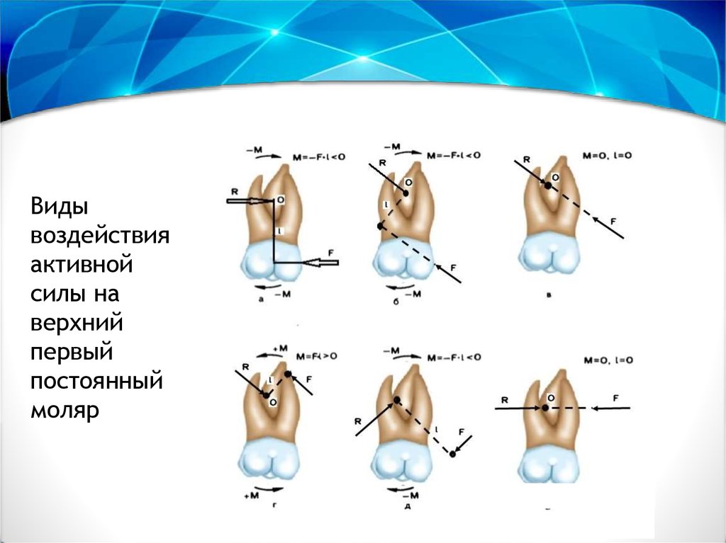 Биомеханика в ортодонтии презентация