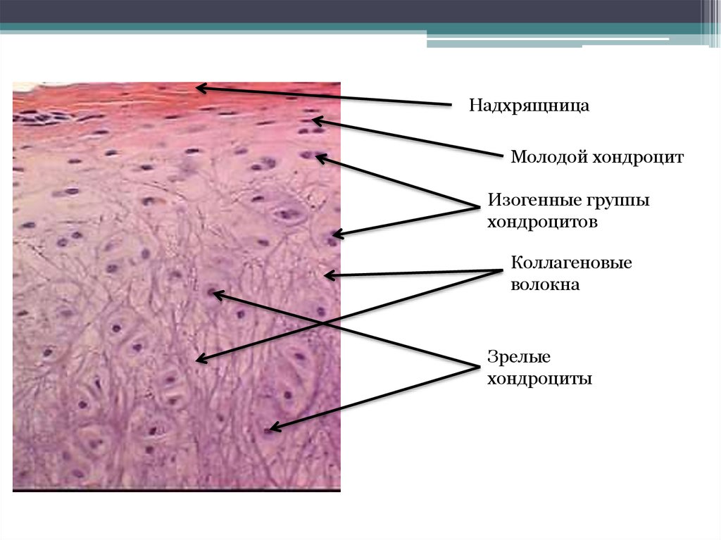 Волокнистый хрящ рисунок