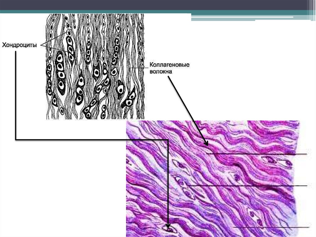 Волокнистый хрящ гистология. Хрящевая гистология. Коллагеново волокнистый хрящ гистология. Надхрящница волокнистого хряща.